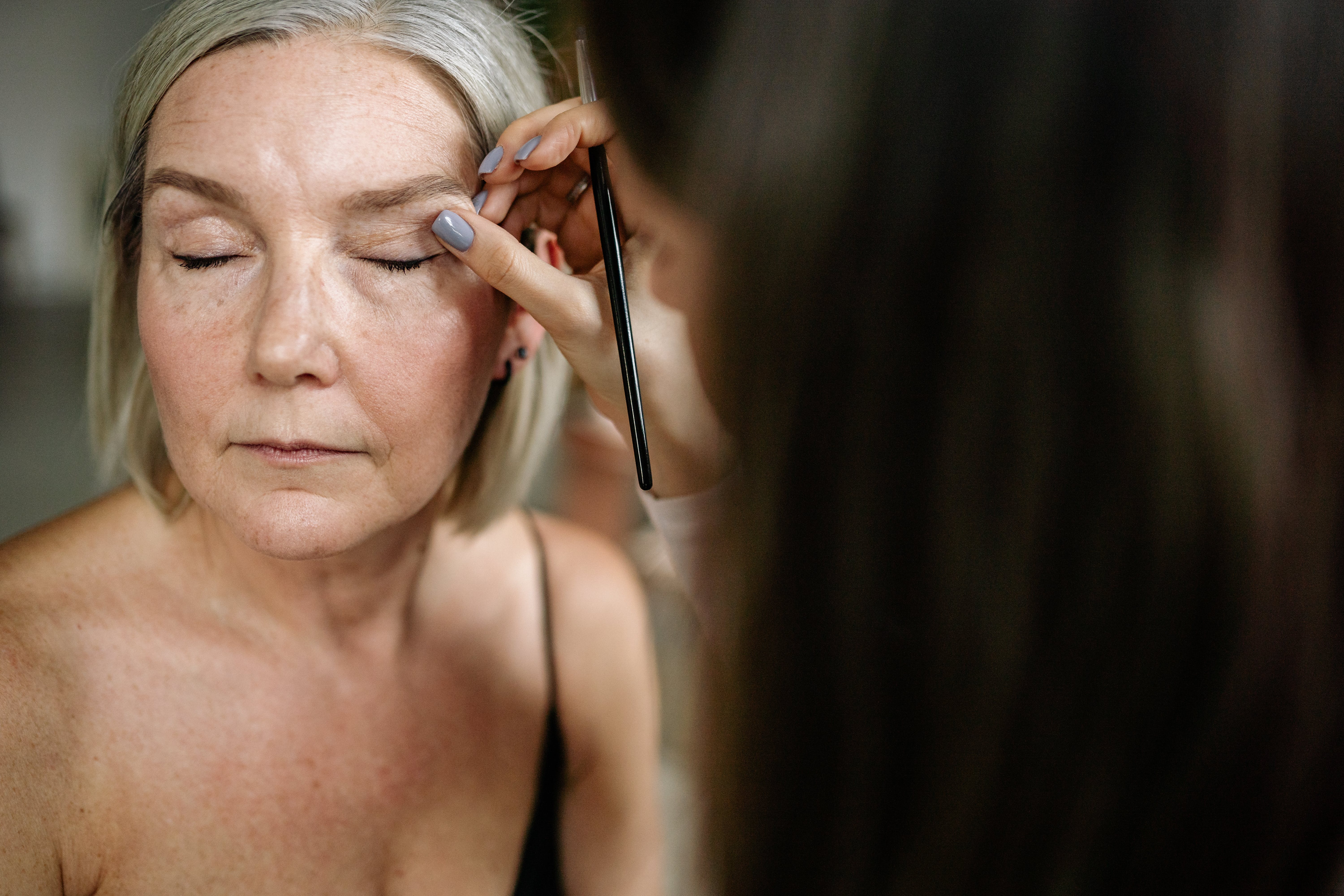 Best and affordable blepharoplasty surgery in Cheadle, Uk