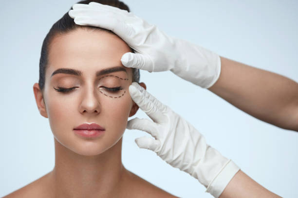 DR ayub Best surgeon for Blepharoplasty in Cheadle uk 