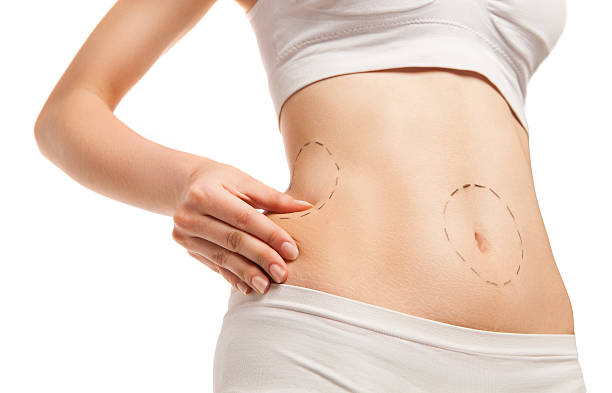 liposuction pic, is liposuction right for you?